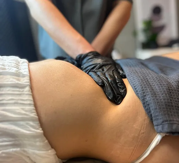 After Lipo massage in Nieuwegein